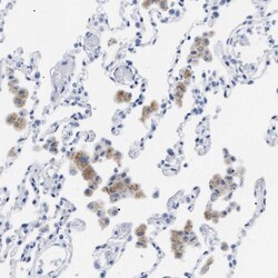 Invitrogen LRWD1 Polyclonal Antibody 100 &mu;L; Unconjugated:Antibodies,