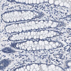 Invitrogen LRWD1 Polyclonal Antibody 100 &mu;L; Unconjugated:Antibodies,