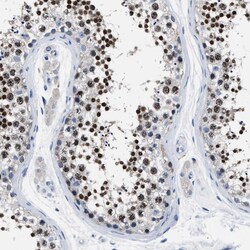 Invitrogen LRWD1 Polyclonal Antibody 100 &mu;L; Unconjugated:Antibodies,