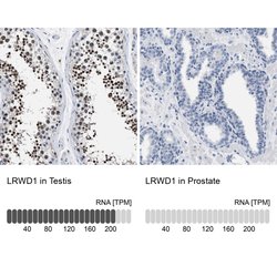 Invitrogen LRWD1 Polyclonal Antibody 100 &mu;L; Unconjugated:Antibodies,