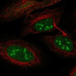 Invitrogen LRWD1 Polyclonal Antibody 100 &mu;L; Unconjugated:Antibodies,