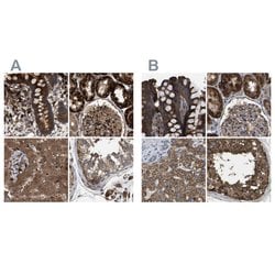 Invitrogen GCC1 Polyclonal Antibody 100 &mu;L; Unconjugated:Antibodies,