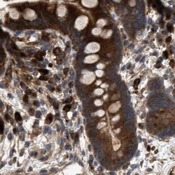 Invitrogen GCC1 Polyclonal Antibody 100 &mu;L; Unconjugated:Antibodies,