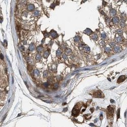 Invitrogen GCC1 Polyclonal Antibody 100 &mu;L; Unconjugated:Antibodies,