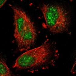 Invitrogen IER5L Polyclonal Antibody 100 &mu;L | Buy Online | Invitrogen&trade; | Fisher Scientific