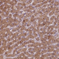 BAAT Polyclonal Antibody 100 &mu;L | Buy Online | Thermo Scientific | Fisher Scientific