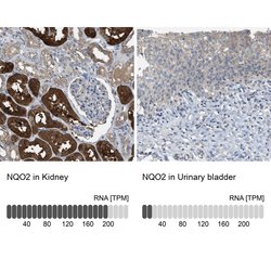 Invitrogen NQO2 Polyclonal Antibody 100 &mu;L; Unconjugated:Antibodies,