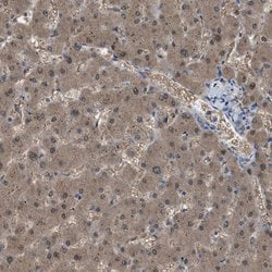 Invitrogen NQO2 Polyclonal Antibody 100 &mu;L; Unconjugated:Antibodies,