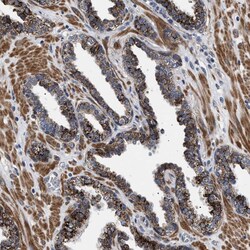 Invitrogen RAB34 Polyclonal Antibody 100 &mu;L; Unconjugated:Antibodies,