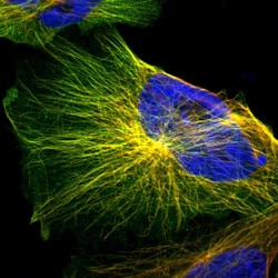 Invitrogen IFT20 Polyclonal Antibody 100 &mu;L; Unconjugated:Antibodies,