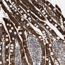 Invitrogen FICD Polyclonal Antibody 100 &mu;L; Unconjugated:Antibodies,