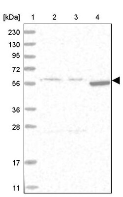 Invitrogen FICD Polyclonal Antibody 100 &mu;L; Unconjugated:Antibodies,