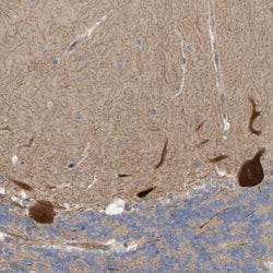 Invitrogen LRSAM1 Polyclonal Antibody 100 &mu;L; Unconjugated:Antibodies,