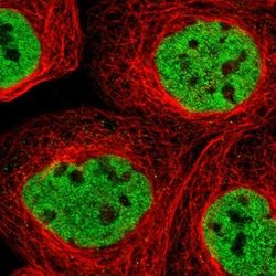 Invitrogen PHF12 Polyclonal Antibody 100 &mu;L | Buy Online | Invitrogen&trade; | Fisher Scientific