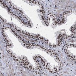 Invitrogen PHF12 Polyclonal Antibody 100 &mu;L | Buy Online | Invitrogen&trade; | Fisher Scientific