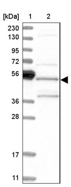 Invitrogen SH3GLB2 Polyclonal Antibody 100 &mu;L | Buy Online | Invitrogen&trade; | Fisher Scientific