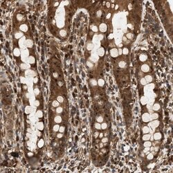 Invitrogen SH3GLB2 Polyclonal Antibody 100 &mu;L; Unconjugated:Antibodies,