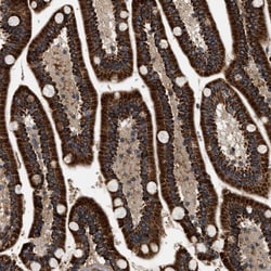 ZBTB26 Polyclonal Antibody:Antibodies, Polyclonal