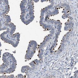 Adenylate Kinase 8 Rabbit anti-Human, Polyclonal, Invitrogen 100 &mu;L;