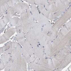 Adenylate Kinase 8 Rabbit anti-Human, Polyclonal, Invitrogen 100 &mu;L;