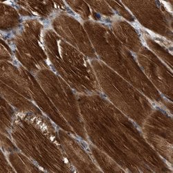 Invitrogen SLC16A3 Polyclonal Antibody 100 &mu;L; Unconjugated:Antibodies,