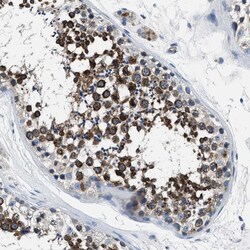 Invitrogen PRTFDC1 Polyclonal Antibody 100 &mu;L; Unconjugated:Antibodies,