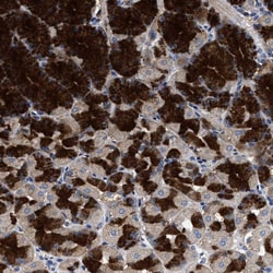 Invitrogen HSD17B14 Polyclonal Antibody 100 &mu;L; Unconjugated:Antibodies,