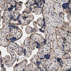 Invitrogen ZADH2 Polyclonal Antibody 100 &mu;L; Unconjugated:Antibodies,