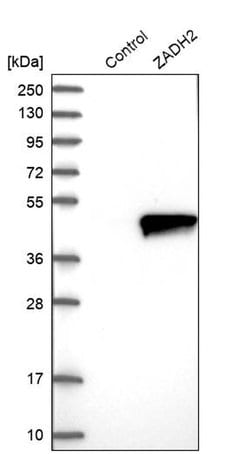 Invitrogen ZADH2 Polyclonal Antibody 100 &mu;L; Unconjugated:Antibodies,
