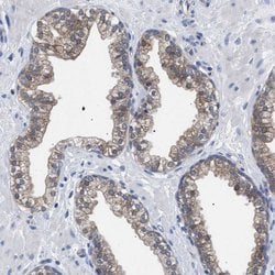GMPR Polyclonal Antibody:Antibodies, Polyclonal