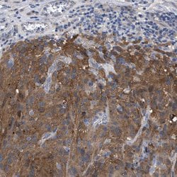 GMPR Polyclonal Antibody:Antibodies, Polyclonal