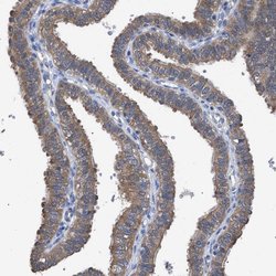 GMPR Polyclonal Antibody:Antibodies, Polyclonal