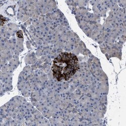 GMPR Polyclonal Antibody:Antibodies, Polyclonal