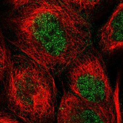 WIPI2 Polyclonal Antibody:Antibodies, Polyclonal