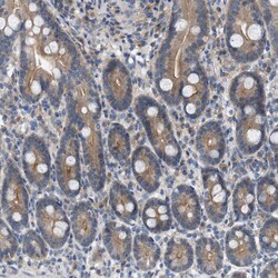 WIPI2 Polyclonal Antibody:Antibodies, Polyclonal