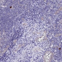 Invitrogen APOBEC3H Polyclonal Antibody 100 &mu;L; Unconjugated:Antibodies,