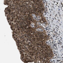 Invitrogen RBM33 Polyclonal Antibody 100 &mu;L; Unconjugated:Antibodies,