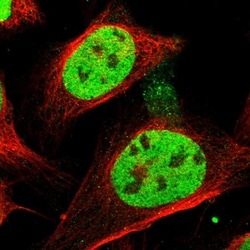 Invitrogen SFRS15 Polyclonal Antibody 100 &mu;L | Buy Online | Invitrogen&trade; | Fisher Scientific