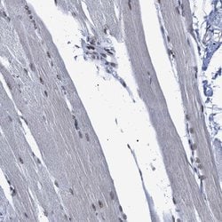 Invitrogen SFRS15 Polyclonal Antibody 100 &mu;L | Buy Online | Invitrogen&trade; | Fisher Scientific