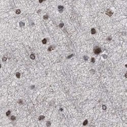 Invitrogen SFRS15 Polyclonal Antibody 100 &mu;L | Buy Online | Invitrogen&trade; | Fisher Scientific