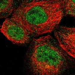 Invitrogen ENTPD8 Polyclonal Antibody 100 &mu;L; Unconjugated:Antibodies,