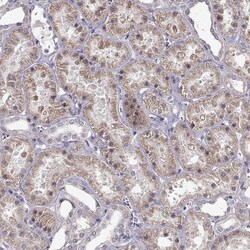 Invitrogen ENTPD8 Polyclonal Antibody 100 &mu;L; Unconjugated:Antibodies,