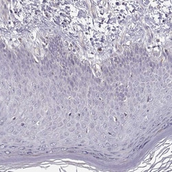 Invitrogen ENTPD8 Polyclonal Antibody 100 &mu;L; Unconjugated:Antibodies,