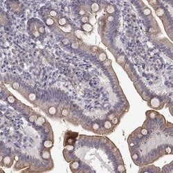 Invitrogen ENTPD8 Polyclonal Antibody 100 &mu;L; Unconjugated:Antibodies,
