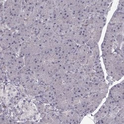 Invitrogen ENTPD8 Polyclonal Antibody 100 &mu;L; Unconjugated:Antibodies,