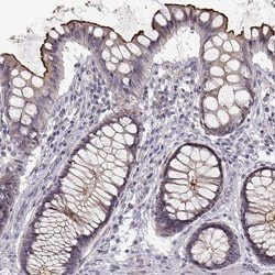 Invitrogen ENTPD8 Polyclonal Antibody 100 &mu;L; Unconjugated:Antibodies,