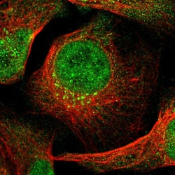 Invitrogen ING2 Polyclonal Antibody 100 &mu;L; Unconjugated:Antibodies,