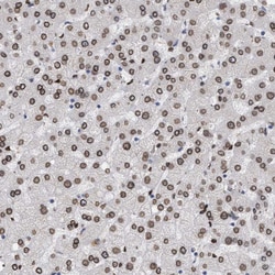 Invitrogen ING2 Polyclonal Antibody 100 &mu;L; Unconjugated:Antibodies,
