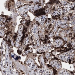 Invitrogen ING2 Polyclonal Antibody 100 &mu;L; Unconjugated:Antibodies,