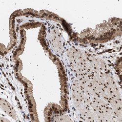 Invitrogen ING2 Polyclonal Antibody 100 &mu;L; Unconjugated:Antibodies,